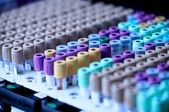 Роспотребнадзор оценил готовность России к новым вирусам